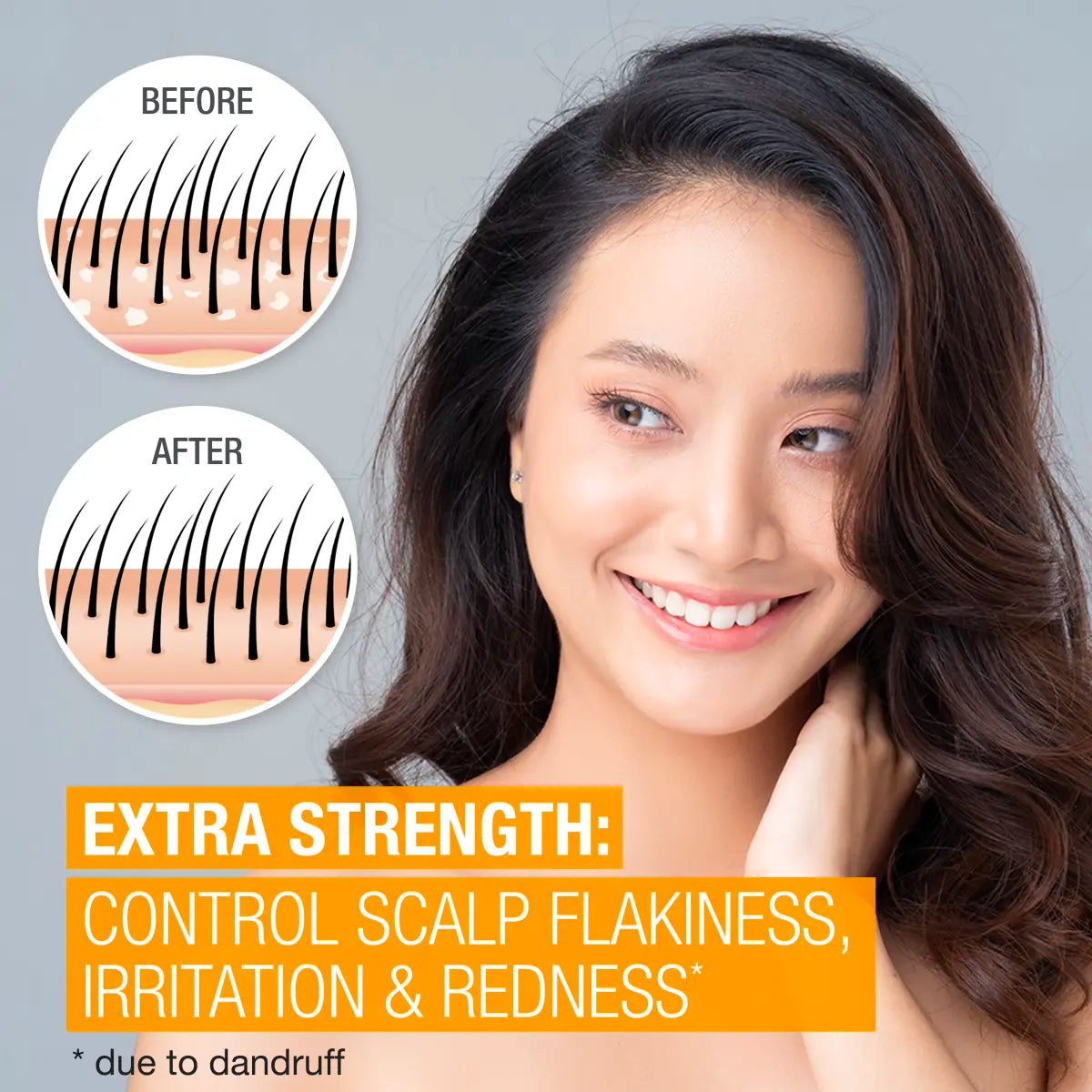 Neutrogena® Scalp Therapy Anti-dandruff Extra Strength