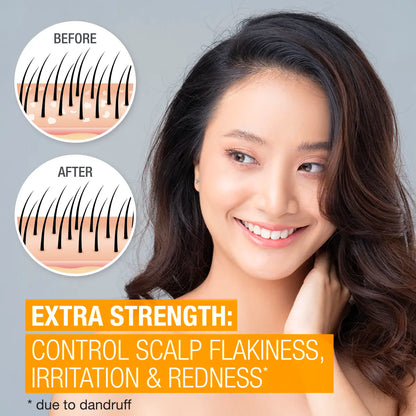 Neutrogena® Scalp Therapy Anti-dandruff Extra Strength