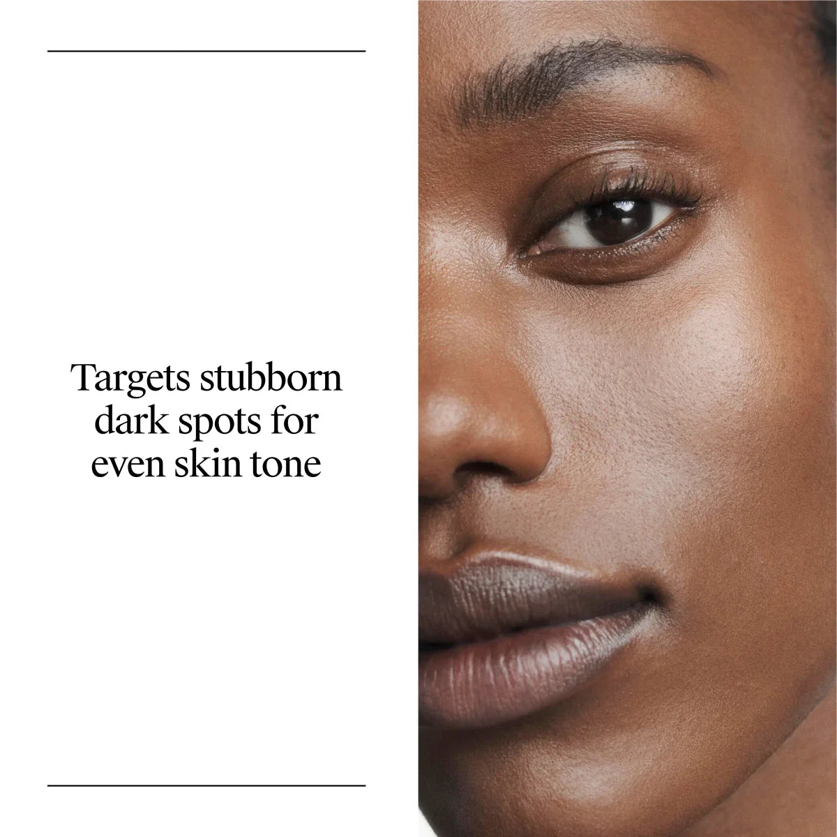 Neutrogena® Rapid Tone Repair Retinol + Vitamin C Dark Spot Corrector, 1 Oz