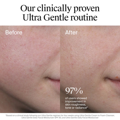Neutrogena® Ultra Gentle Daily Facial Moisturizer with Broad Spectrum SPF 30, 3.4 Fl. Oz