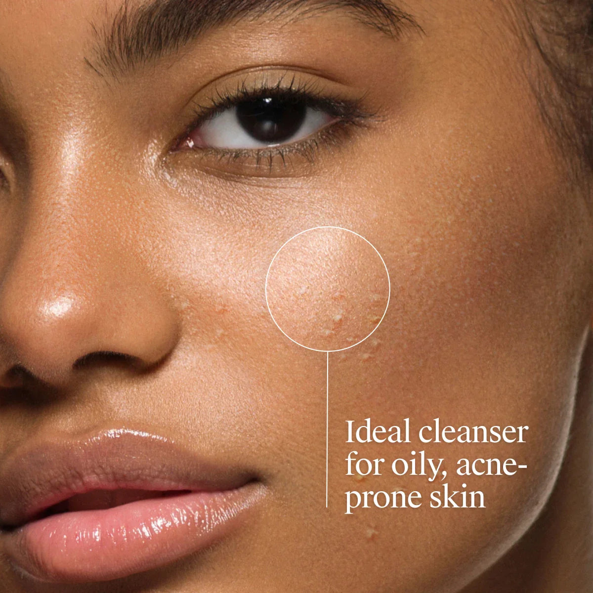 Neutrogena® Oil‑Free Acne Wash with Salicylic Acid, 6 Fl. Oz