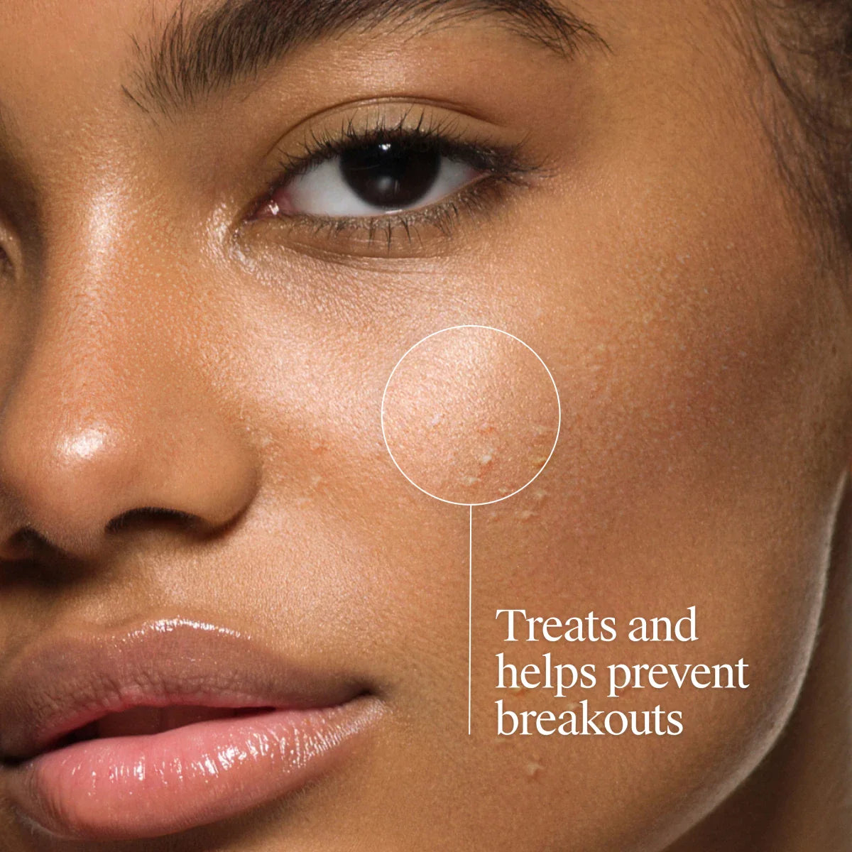 Neutrogena® Oil-Free Acne Wash, Fragrance Free 9.1 FL. Oz