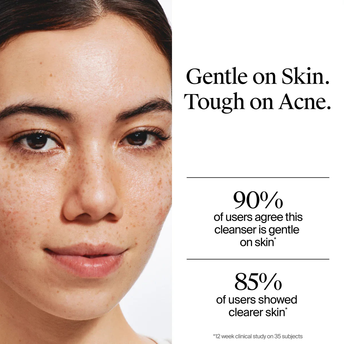 Neutrogena® Oil-Free Acne Wash, Fragrance Free 9.1 FL. Oz