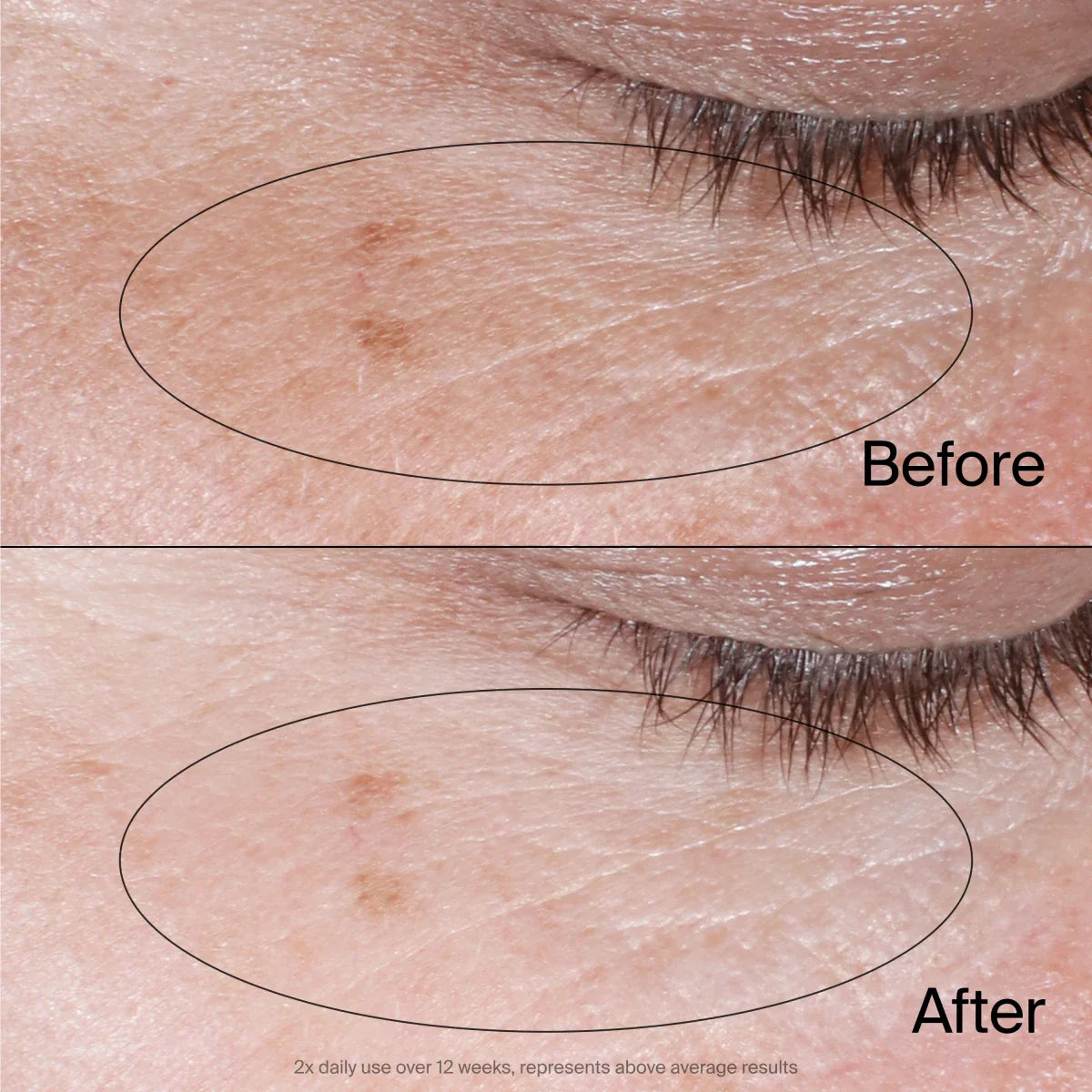 Neutrogena® Collagen Bank Reviving Eye Gel Cream, 0.5 Oz