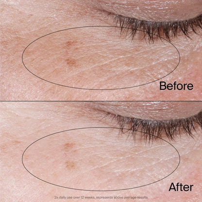 Neutrogena® Collagen Bank Reviving Eye Gel Cream, 0.5 Oz
