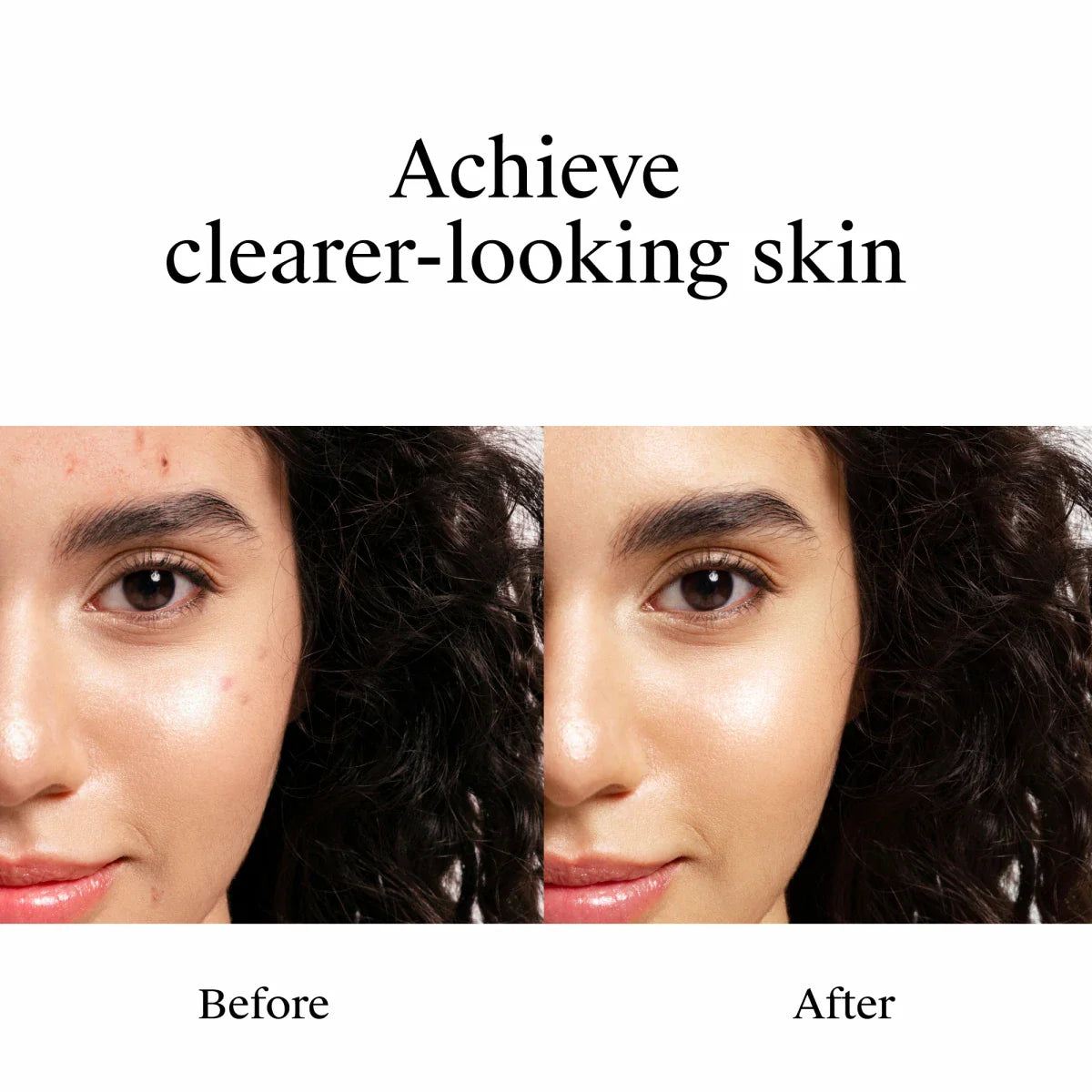 Neutrogena® Rapid Clear Stubborn Acne Spot Gel, 1 Oz