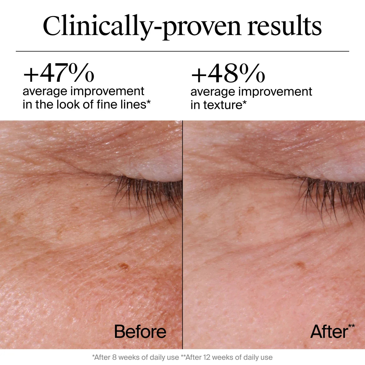 Neutrogena® Rapid Wrinkle Regenerating Repair Regenerating Cream, 1.7 Oz