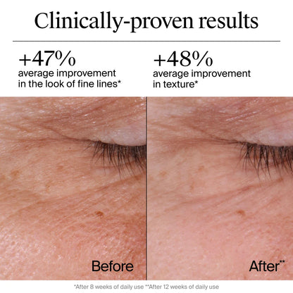 Neutrogena® Rapid Wrinkle Regenerating Repair Regenerating Cream, 1.7 Oz